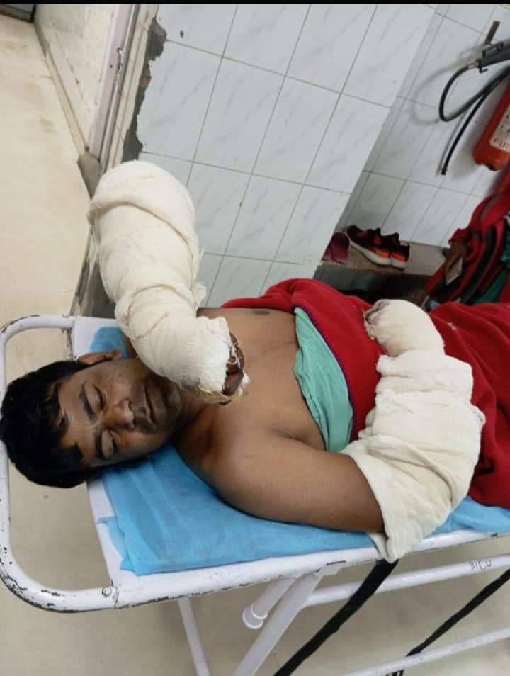 Urgent Appeal For Support Pintu Lal's Life-Altering Electrical Accident